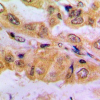 SMAD2 (Phospho-S467) Rabbit Polyclonal Antibody