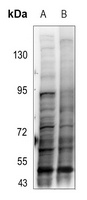 SMAD3 (Phospho-T179) Rabbit Polyclonal Antibody