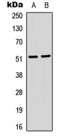SRF (Phospho-S103) Rabbit Polyclonal Antibody