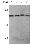 STAT2 (Phospho-Y690) Rabbit Polyclonal Antibody