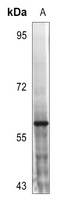 MST1/2 (Phospho-T183) Rabbit Polyclonal Antibody