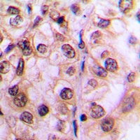 MST1/2 (Phospho-T183) Rabbit Polyclonal Antibody