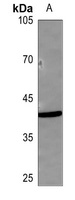 TBP Rabbit Polyclonal Antibody