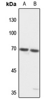 TCF4/12 Rabbit Polyclonal Antibody