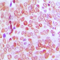 TCF4/12 Rabbit Polyclonal Antibody