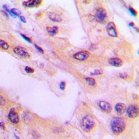 ACK1 (Phospho-Y284) Rabbit Polyclonal Antibody