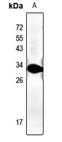 cTnI Rabbit Polyclonal Antibody