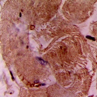cTnI Rabbit Polyclonal Antibody