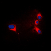 cTnI Rabbit Polyclonal Antibody