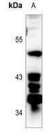 p53 (Phospho-S392) Rabbit Polyclonal Antibody