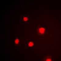 p53 (Phospho-S392) Rabbit Polyclonal Antibody