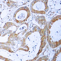 TRADD Rabbit Polyclonal Antibody