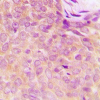 UBA5 Antibody