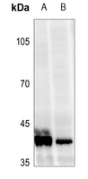 VDR (Phospho-S208) Rabbit Polyclonal Antibody