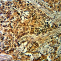 VIPR1 Antibody