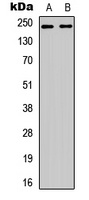 WNK1 (Phospho-T60) Antibody