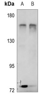RACK7 Rabbit Polyclonal Antibody
