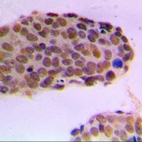 RACK7 Rabbit Polyclonal Antibody