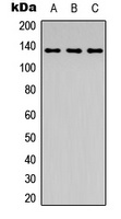 ABL1 (Phospho-Y204) Rabbit Polyclonal Antibody