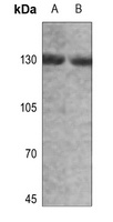 Alpha-adducin (Phospho-T445) Rabbit Polyclonal Antibody