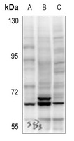 AKT (Phospho-S473) Antibody