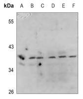 PRAS40 (Phospho-T246) Rabbit Polyclonal Antibody