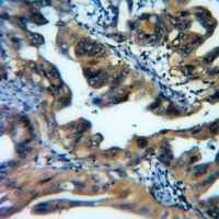 ATG16L1 Rabbit Polyclonal Antibody