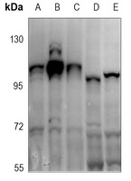 ATP1A1 (Phospho-S16) Rabbit Polyclonal Antibody