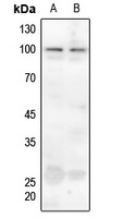 Ataxin 1 (Phospho-S775) Rabbit Polyclonal Antibody