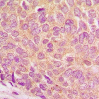 Ataxin 1 (Phospho-S775) Rabbit Polyclonal Antibody