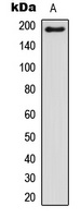 BCOR Rabbit Polyclonal Antibody