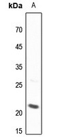 BID Rabbit Polyclonal Antibody