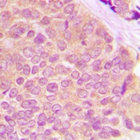 BMX (Phospho-Y566) Rabbit Polyclonal Antibody