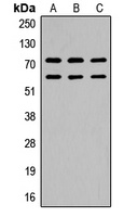 CaMK2 beta/gamma (Phospho-T287) Rabbit Polyclonal Antibody