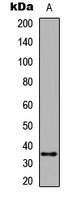 Caspase 6 Rabbit Polyclonal Antibody