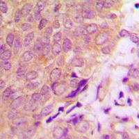 Caspase 6 Rabbit Polyclonal Antibody