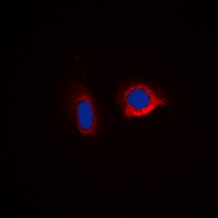 Caspase 6 Rabbit Polyclonal Antibody