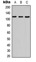 c-CBL (Phospho-Y700) Rabbit Polyclonal Antibody