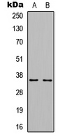 Cyclin D1 (Phospho-T286) Rabbit Polyclonal Antibody