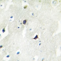 Cadherin 7 Rabbit Polyclonal Antibody
