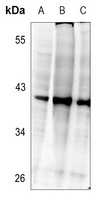C/EBP beta (Phospho-T235) Rabbit Polyclonal Antibody