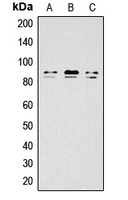 IKK alpha/beta (Phospho-S176/177) Rabbit Polyclonal Antibody