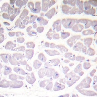 IKK alpha/beta (Phospho-S176/177) Rabbit Polyclonal Antibody