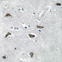Collagen 11 alpha 2 Antibody