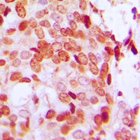 DAXX (Phospho-S668) Rabbit Polyclonal Antibody