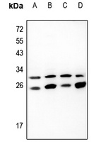 EIF3K Rabbit Polyclonal Antibody