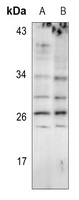EIF4E3 Rabbit Polyclonal Antibody