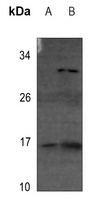 4EBP1 (Phospho-T69) Rabbit Polyclonal Antibody