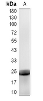 STARD4 Rabbit Monoclonal Antibody