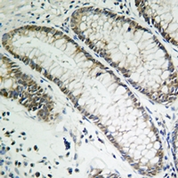Cyclin E1 Rabbit Monoclonal Antibody